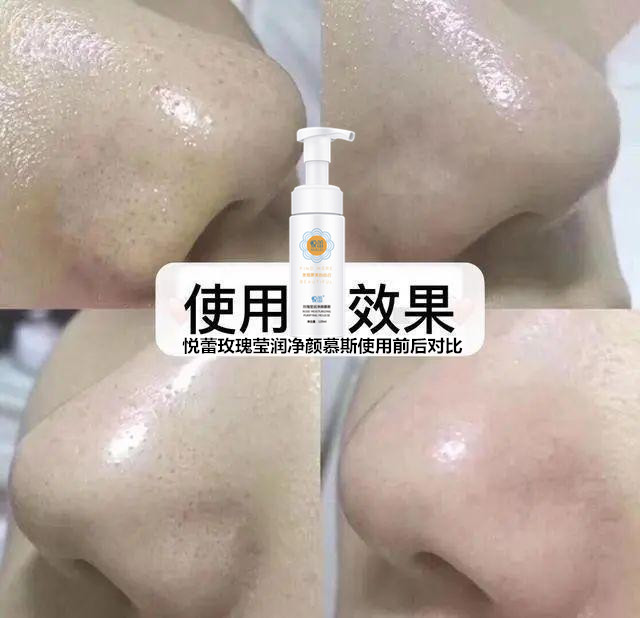 清洁不到位,护肤白费!悦蕾玫瑰莹润净颜慕斯,疏通毛孔告别痘肌困扰